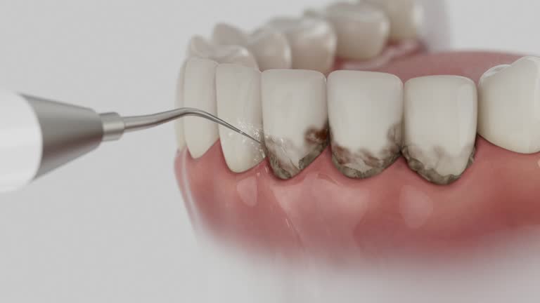 Reliable Dental Implants contractor in Hubbard, OH by Smile Center Dentistry